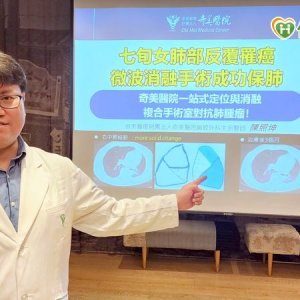七旬女肺部反覆罹癌　「微創消融手術」消弭開刀難題成功保肺