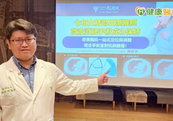 七旬女肺部反覆罹癌　「微創消融手術」消弭開刀難題成功保肺