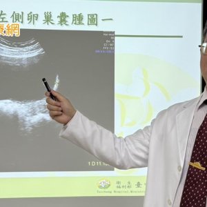 旅日前卵巢扭轉腹痛掛急診　緊急手術切除囊腫保卵巢