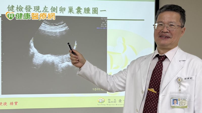 旅日前卵巢扭轉腹痛掛急診 緊急手術切除囊腫保卵巢 旅日前卵巢扭轉腹痛掛急診 緊急手術切除囊腫保卵巢
