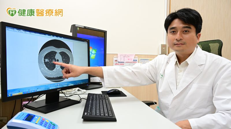 老婦「肺小結節」定期追蹤十年卻變癌 機器手臂切除救回一命 老婦「肺小結節」定期追蹤十年卻變癌 機器手臂切除救回一命