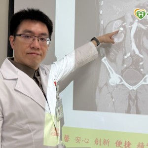 兩年三次腎結石　中年男腎出血後改「1手術」成功碎石