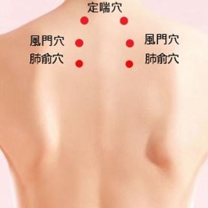 一變天就鼻塞？中醫師：三伏貼改善鼻炎有幫助　但這些人要慎用