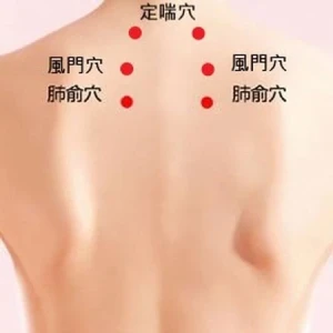 一變天就鼻塞？中醫師：三伏貼改善鼻炎有幫助　但這些人要慎用