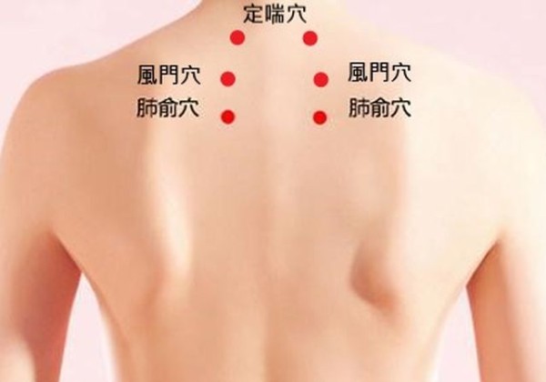 一變天就鼻塞？中醫師：三伏貼改善鼻炎有幫助　但這些人要慎用