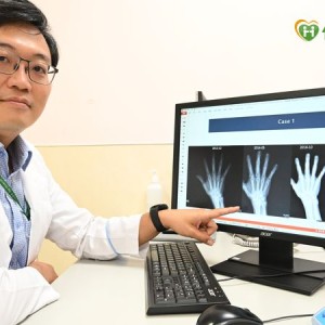 類風濕性關節炎不是不痛就沒事！　醫破解迷思：骨頭恐已悄悄被侵蝕