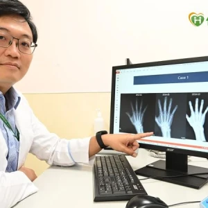 類風濕性關節炎不是不痛就沒事！　醫破解迷思：骨頭恐已悄悄被侵蝕