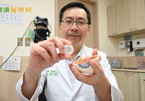 73歲婦誦經看不清怕念錯！竟是白內障惹禍　手術後視野如「開光」