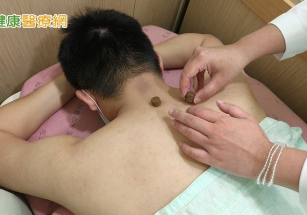 三伏貼改善鼻過敏有解！　中醫師提醒：這3天記得貼滿