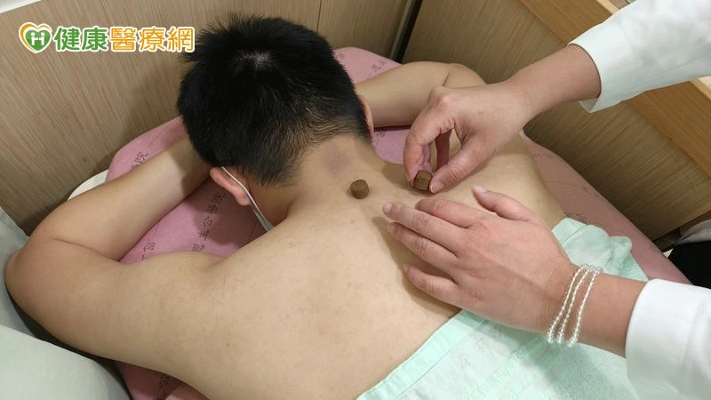 三伏貼改善鼻過敏有解！　中醫師提醒：這3天記得貼滿