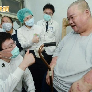中年男體重飆破280公斤　「1治療」成功助減重200公斤