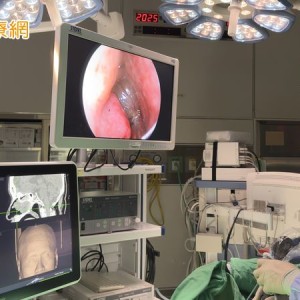 鼻息肉復發鼻塞愈來愈嚴重　「新型治療」助她重拾順暢呼吸