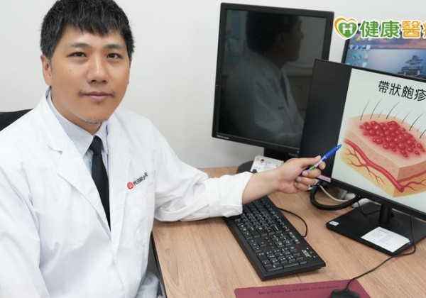 男側腹痛掛泌尿科無異常　三天後出紅疹痛到難眠才知「皮蛇」上身