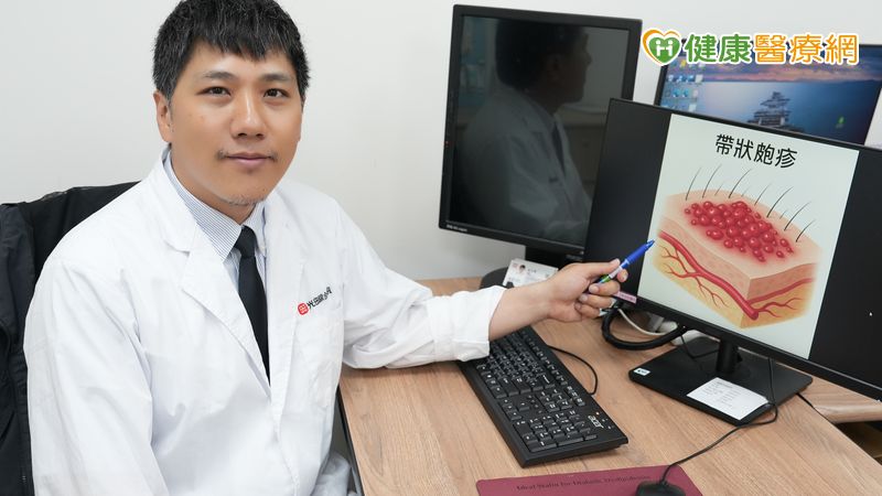男側腹痛掛泌尿科無異常　三天後出紅疹痛到難眠才知「皮蛇」上身