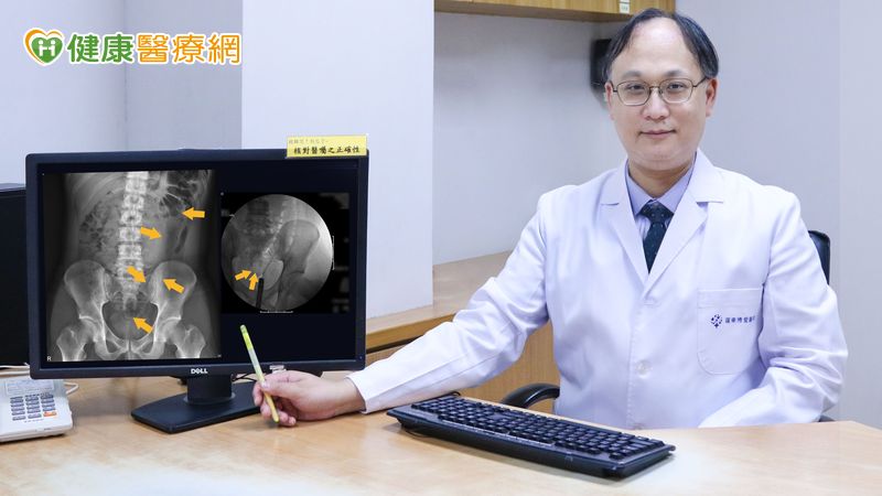 20歲男下腹劇痛　X光透視一照竟是「35公分按摩棒」卡腸