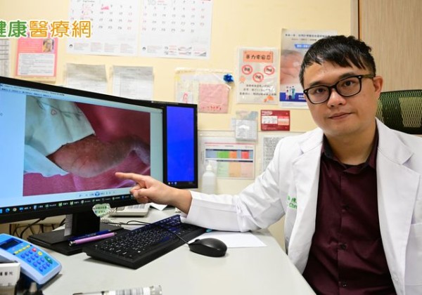 新生女嬰全身長滿小水泡紅疹　竟是罕病「色素失調症」
