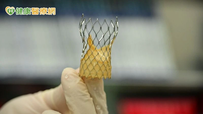 7旬洗腎翁主動脈狹窄復發　植入「瓣中瓣」重獲心生機