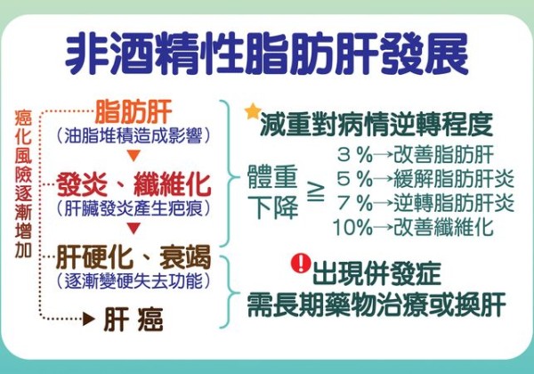 脂肪肝炎如沉默炸彈　除了減重、吃藥更應從生活型態改善