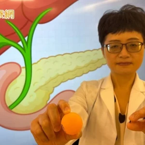 1歲多幼童腹痛確診總膽管囊腫　單孔微創手術助減少疼痛、不留疤