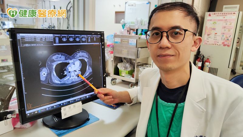 生產隔日下床突休克 醫籲:產後併發「肺栓塞」致命性高 生產隔日下床突休克 醫籲:產後併發「肺栓塞」致命性高