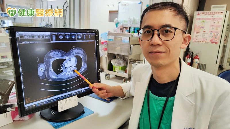 生產隔日下床突休克　醫籲：產後併發「肺栓塞」致命性高