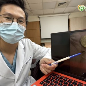 胸痛半天誤當心肌梗塞　竟是魚刺卡在食道裡