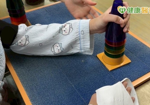 重組大腦神經迴路!限制誘發動作療法助中風患者重拾手部功能 重組大腦神經迴路!限制誘發動作療法助中風患者重拾手部功能