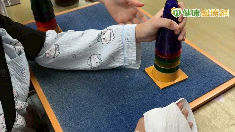 重組大腦神經迴路！限制誘發動作療法助中風患者重拾手部功能