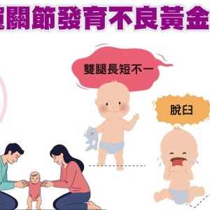 孩子換尿布有咔嗒怪聲？醫：恐是髖部問題　及早發現避免終生跛行