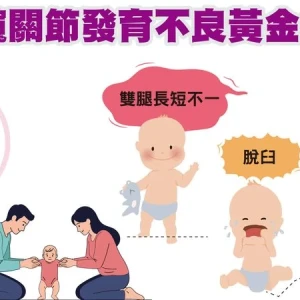 孩子換尿布有咔嗒怪聲？醫：恐是髖部問題　及早發現避免終生跛行