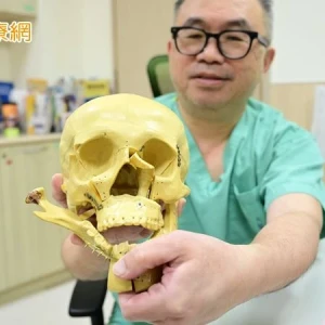 建築工5米墜落臉變形！「隱形重建」恢復顏面原貌　外表完全無疤