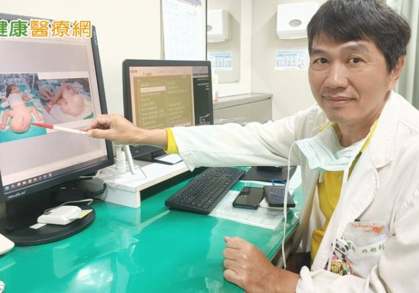 10週長大4倍！女嬰帶16公分「大球」出生　竟是罕見畸胎瘤