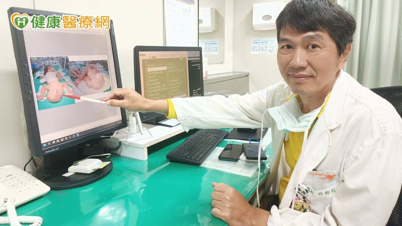 10週長大4倍！女嬰帶16公分「大球」出生　竟是罕見畸胎瘤