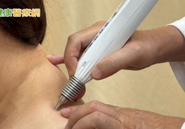 傳統針灸再進化！雷射針灸無痛解不適　怕針族也能安心治療