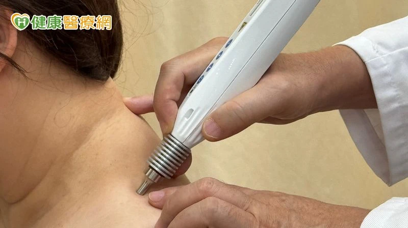 傳統針灸再進化！雷射針灸無痛解不適　怕針族也能安心治療