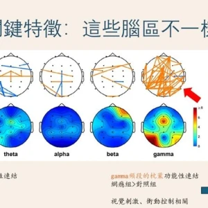 人手一機更易陷網路成癮　國衛院用「腦波」結合AI揪出早期警訊！