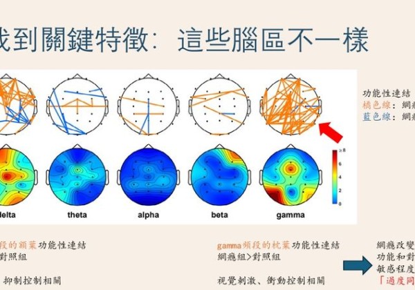 人手一機更易陷網路成癮　國衛院用「腦波」結合AI揪出早期警訊！