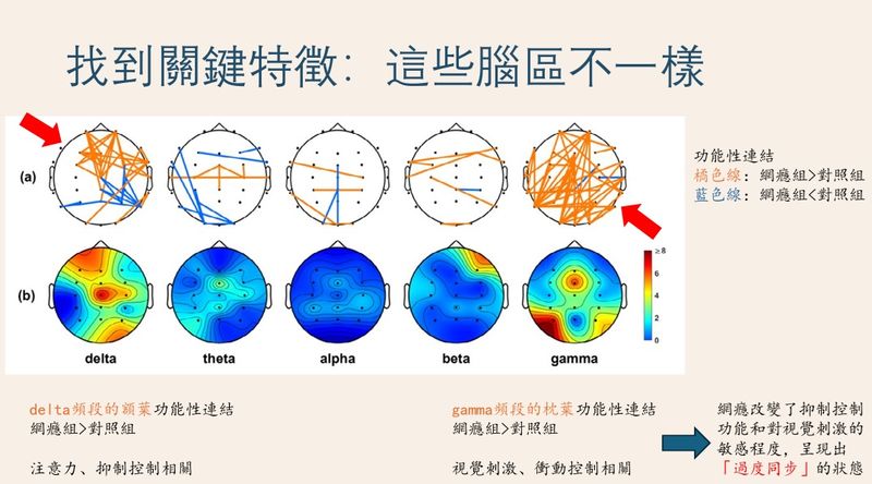 人手一機更易陷網路成癮　國衛院用「腦波」結合AI揪出早期警訊！