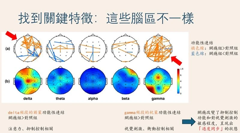 人手一機更易陷網路成癮　國衛院用「腦波」結合AI揪出早期警訊！