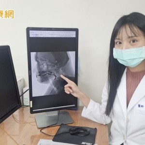 只剩8顆牙進食困難，加「增稠劑」反降食慾　專家教4招訓練吞嚥