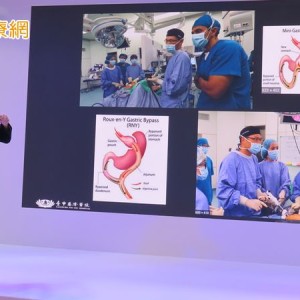 男胖到135公斤陷換心危機　「這樣做」成功助病態肥胖者逆轉心衰危機