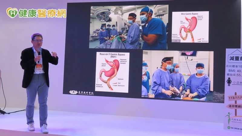 男胖到135公斤陷換心危機 「這樣做」成功助病態肥胖者逆轉心衰危機 男胖到135公斤陷換心危機 「這樣做」成功助病態肥胖者逆轉心衰危機