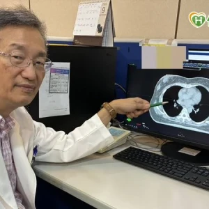 51歲婦乳房摸到硬塊確診乳癌　乳房保留手術結合新型放射治療降復發