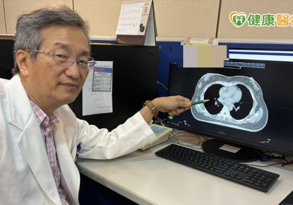 51歲婦乳房摸到硬塊確診乳癌　乳房保留手術結合新型放射治療降復發