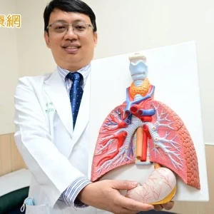 以為胃食道逆流竟是第三期食道癌　微創手術重建老菸槍食道保命